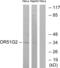 Olfactory Receptor Family 51 Subfamily G Member 2 antibody, abx015372, Abbexa, Western Blot image 