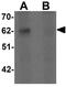 SPRY Domain Containing 3 antibody, GTX32022, GeneTex, Western Blot image 