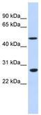 Zinc Finger Protein 556 antibody, TA341403, Origene, Western Blot image 