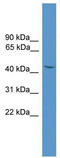 Synaptotagmin 11 antibody, TA342625, Origene, Western Blot image 