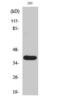 Matrix Metallopeptidase 23B antibody, GTX86949, GeneTex, Western Blot image 