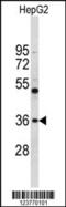 ELOVL Fatty Acid Elongase 2 antibody, MBS9203365, MyBioSource, Western Blot image 