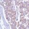 Catenin delta-1 antibody, MA5-16386, Invitrogen Antibodies, Immunohistochemistry paraffin image 