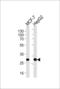 Proteasome Activator Subunit 2 antibody, LS-C162250, Lifespan Biosciences, Western Blot image 