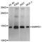 Small Nuclear Ribonucleoprotein D1 Polypeptide antibody, abx127055, Abbexa, Western Blot image 