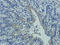 MDM2 Proto-Oncogene antibody, orb345546, Biorbyt, Immunohistochemistry paraffin image 
