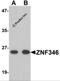 Zinc Finger Protein 346 antibody, 6003, ProSci Inc, Western Blot image 