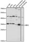 Bridging Integrator 3 antibody, GTX66384, GeneTex, Western Blot image 