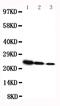 Growth Hormone 1 antibody, RP1007, Boster Biological Technology, Western Blot image 