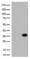 Nicotinamide Riboside Kinase 2 antibody, LS-C796512, Lifespan Biosciences, Western Blot image 
