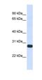 Serine Peptidase Inhibitor, Kunitz Type 2 antibody, orb330593, Biorbyt, Western Blot image 