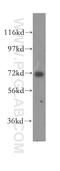 Coiled-Coil Domain Containing 22 antibody, 16636-1-AP, Proteintech Group, Western Blot image 