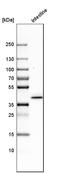 Keratin 20 antibody, HPA024309, Atlas Antibodies, Western Blot image 
