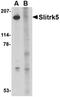 SLIT And NTRK Like Family Member 5 antibody, orb74942, Biorbyt, Western Blot image 