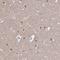 Chromosome 2 Open Reading Frame 70 antibody, NBP2-32360, Novus Biologicals, Immunohistochemistry frozen image 