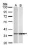 Enoyl-CoA Hydratase 1 antibody, PA5-27920, Invitrogen Antibodies, Western Blot image 