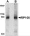 CD180 antigen antibody, 3845, ProSci, Western Blot image 