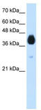 Distal-Less Homeobox 5 antibody, TA343517, Origene, Western Blot image 