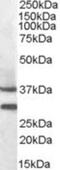 Melanocortin 5 Receptor antibody, NBP1-36971, Novus Biologicals, Western Blot image 