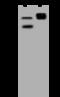 LIF Receptor Subunit Alpha antibody, 50423-T48, Sino Biological, Western Blot image 