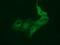 Bestrophin 3 antibody, GTX84830, GeneTex, Immunofluorescence image 