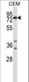 SNK antibody, LS-C164539, Lifespan Biosciences, Western Blot image 