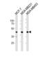 Gamma-sarcoglycan antibody, abx034868, Abbexa, Western Blot image 