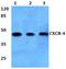 C-X-C Motif Chemokine Receptor 4 antibody, AP01296PU-N, Origene, Western Blot image 