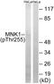 MAP kinase-interacting serine/threonine-protein kinase 1 antibody, GTX55446, GeneTex, Western Blot image 