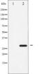 Cyclic AMP-dependent transcription factor ATF-1 antibody, TA325230, Origene, Western Blot image 