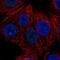 Zinc Finger Protein 778 antibody, NBP2-33637, Novus Biologicals, Immunofluorescence image 