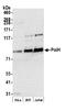 DNA Polymerase Eta antibody, A301-231A, Bethyl Labs, Western Blot image 