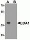 EDA-A1 antibody, NBP2-81908, Novus Biologicals, Western Blot image 