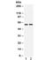 DGAT1 antibody, R31838, NSJ Bioreagents, Western Blot image 