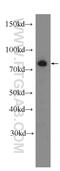 Cytoskeleton-associated protein 2-like antibody, 17143-1-AP, Proteintech Group, Western Blot image 
