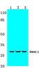 Snail Family Transcriptional Repressor 1 antibody, AP20370PU-N, Origene, Western Blot image 
