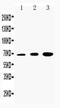 Dopamine Receptor D2 antibody, PA5-79169, Invitrogen Antibodies, Western Blot image 
