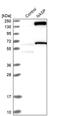 Nuclear Autoantigenic Sperm Protein antibody, PA5-55776, Invitrogen Antibodies, Western Blot image 