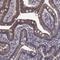 Cytochrome P450 Family 2 Subfamily S Member 1 antibody, HPA069248, Atlas Antibodies, Immunohistochemistry frozen image 