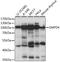 Sphingomyelin phosphodiesterase 4 antibody, A15473, ABclonal Technology, Western Blot image 