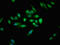Ubiquitin carboxyl-terminal hydrolase CYLD antibody, LS-C672368, Lifespan Biosciences, Immunofluorescence image 