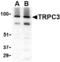 Short transient receptor potential channel 3 antibody, TA306352, Origene, Western Blot image 