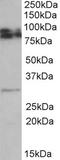 Glycoprotein M6A antibody, EB10558, Everest Biotech, Western Blot image 