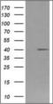 High affinity immunoglobulin gamma Fc receptor I antibody, orb313966, Biorbyt, Western Blot image 