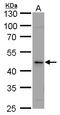 Calsequestrin-2 antibody, TA308184, Origene, Western Blot image 