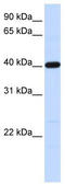 Tropomodulin 3 antibody, TA334548, Origene, Western Blot image 