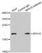Ribosomal Protein S10 antibody, LS-C335612, Lifespan Biosciences, Immunoprecipitation image 