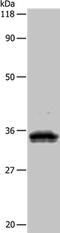 Uroplakin 3B antibody, PA5-50187, Invitrogen Antibodies, Western Blot image 