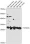 Tetraspanin 31 antibody, A14079, Boster Biological Technology, Western Blot image 
