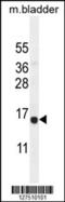 Cysteine Rich Hydrophobic Domain 2 antibody, 55-201, ProSci, Western Blot image 